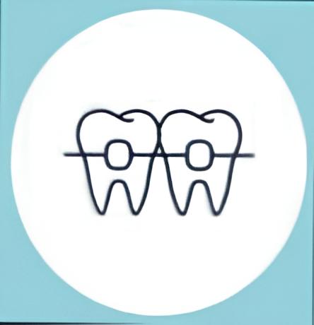 Braces installation service at Dental Clinic Your Smile in Cyprus