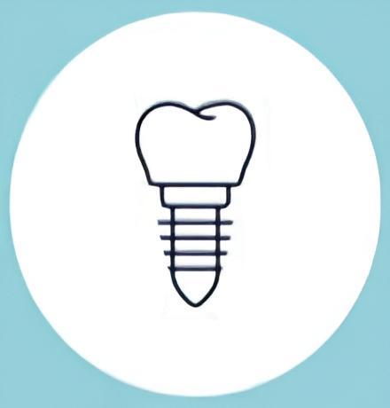 Dental implants procedure at Dental Clinic Your Smile in Cyprus